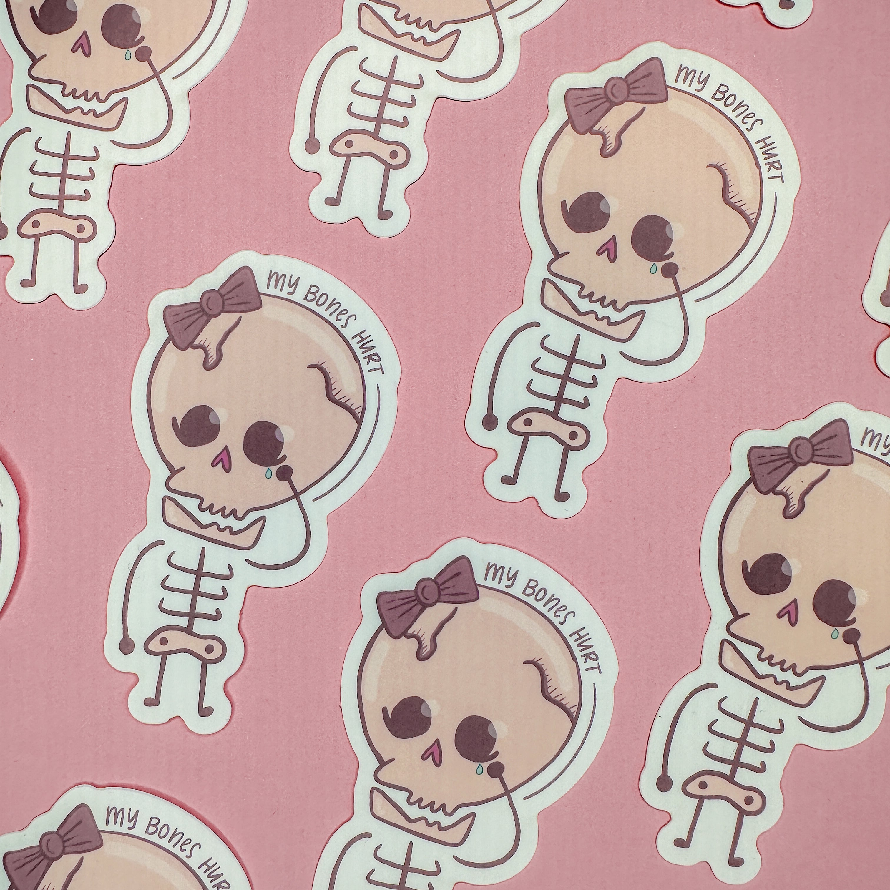 My Bones Hurt Sticker